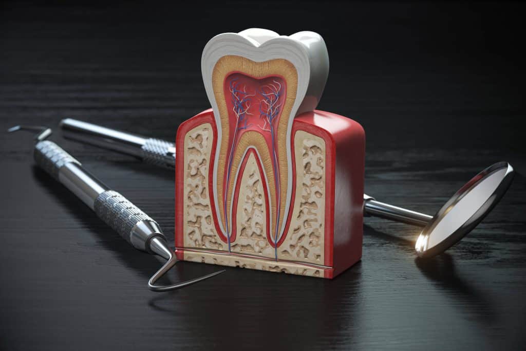 Root Canal Symptoms: Six Warning Signs You Need A Root Canal