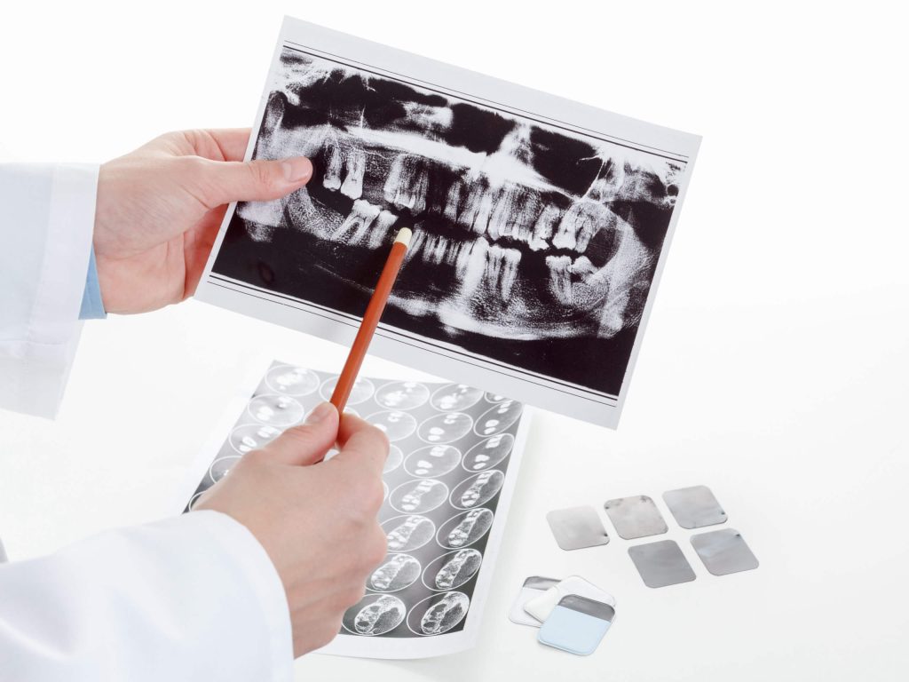 The Path to Becoming an Endodontist