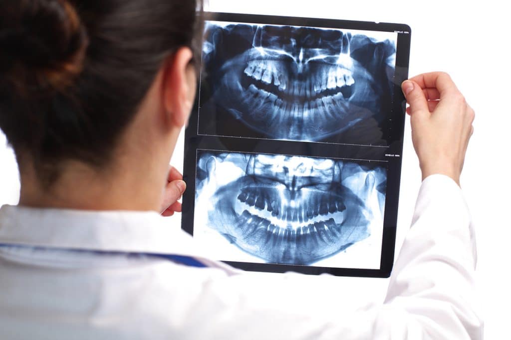 Cone Beam CT vs. Traditional CT Scans: Which is Better for Dental Imaging?