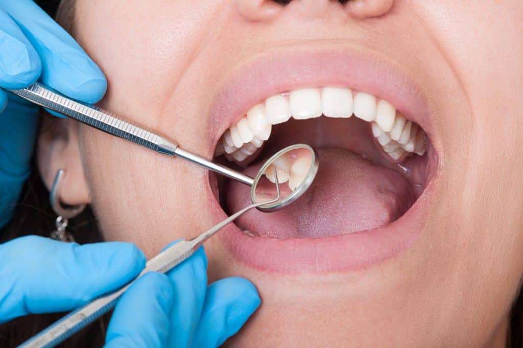Oral Hygiene Best Practices
